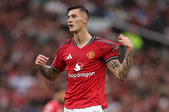 Sesko cần phải điên hơn ở MU