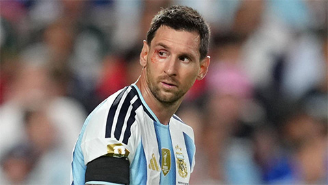 Messi lỡ buổi tập của Argentina trước trận gặp Anh